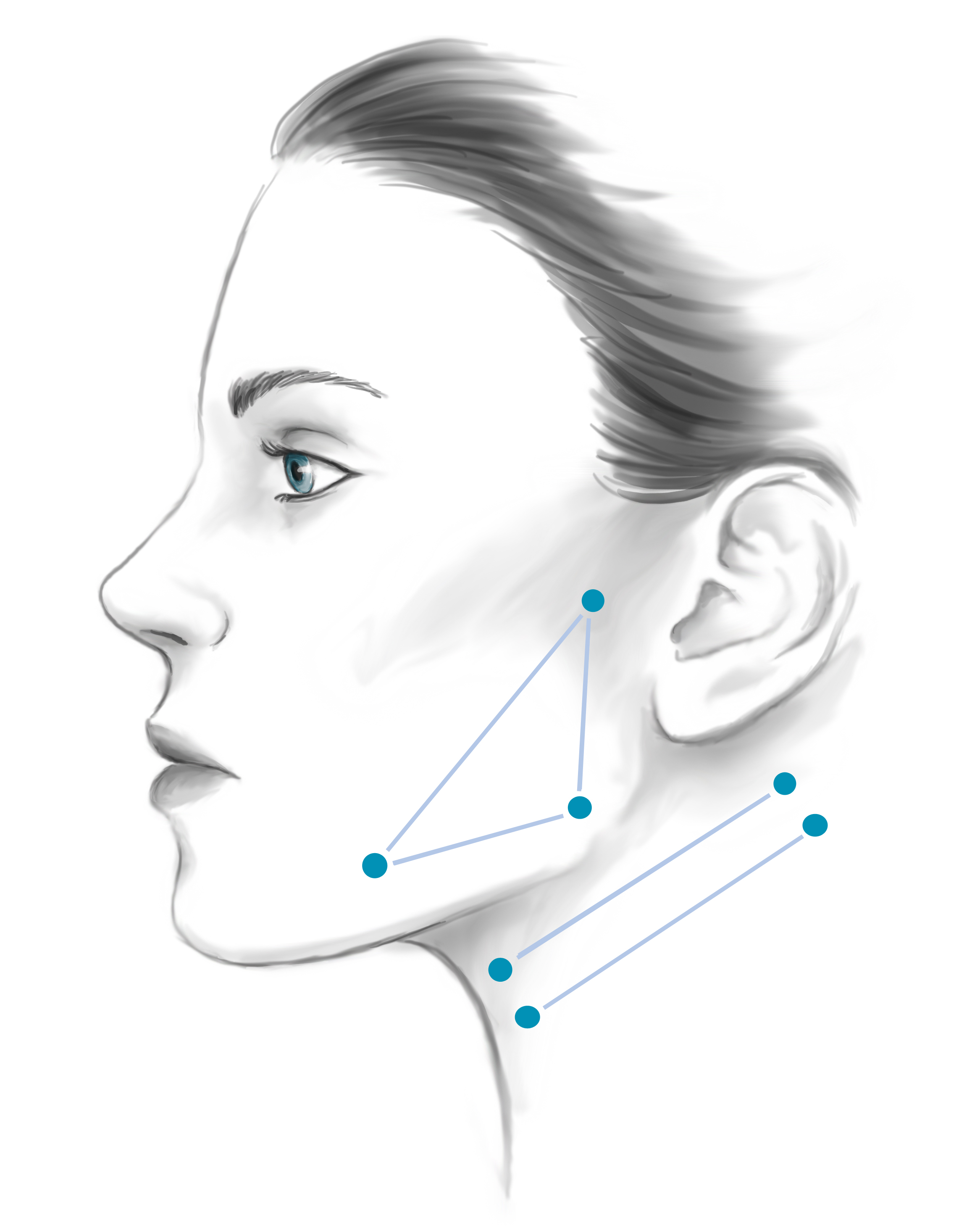 Side profile illustration of woman's face identifying cheekbones and neck for face lift
