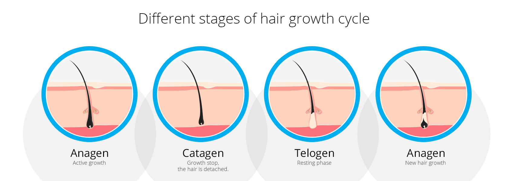 Diagram illustrating four different stages of hair growth