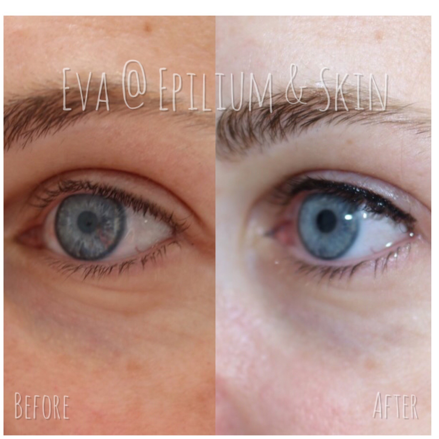 Before and after woman's eyes of permanent eyeliner tattoo