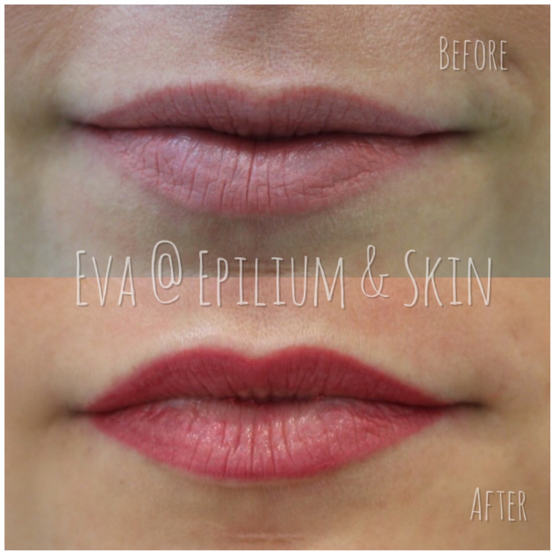 Before and after woman's lips after semi permanent Makeup treatment for fullness, definition, and colour intensity