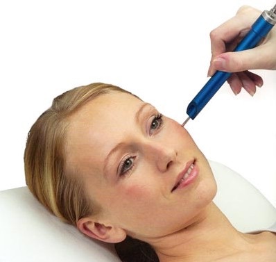 Woman laying down receiving dermapen treatment on face